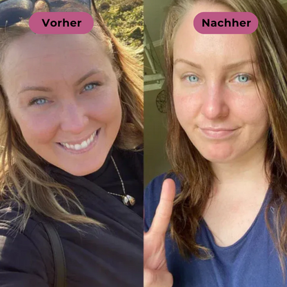 Livio Balm™ | Straffender Multi-Balm