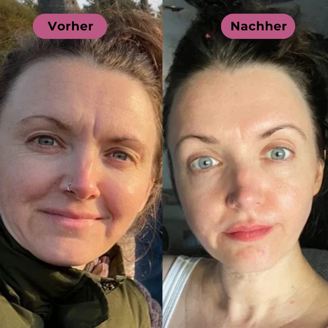 Livio Balm™ | Straffender Multi-Balm