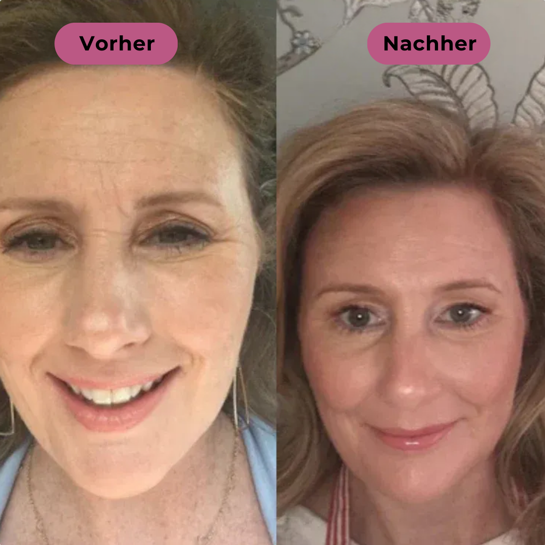 Livio Balm™ | Straffender Multi-Balm